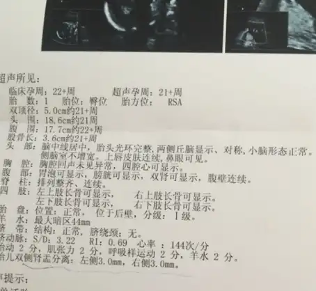 b超单上这3个数据,或许是宝宝给你"暗示",自己是个"小公主"_时候_妈妈