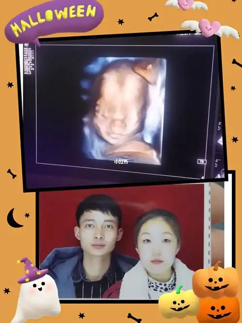 记录宝宝的第一张照片,四维一次过,好乖好配合00我感觉鼻子像我