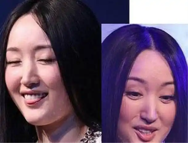 杨钰莹晒素颜照, "不老女神"人设崩塌, 网友: 玻尿酸后遗症!