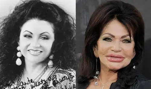 10大整容失败,女神变恐怖"鬼新娘"的悲惨女明星