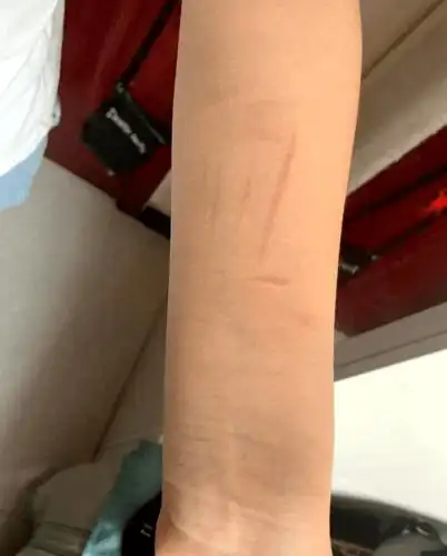 运城盐湖区教科局回应女生遭猥亵抑郁自残责令学校开除涉事老师