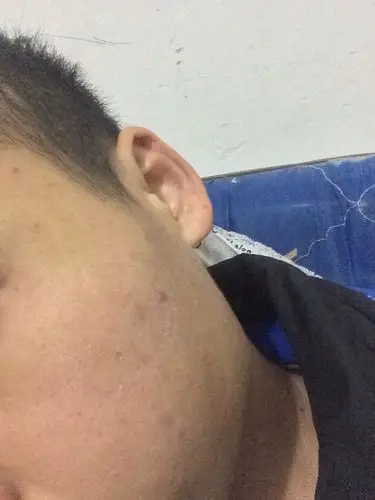 敏感性皮肤用什么护肤品,男.