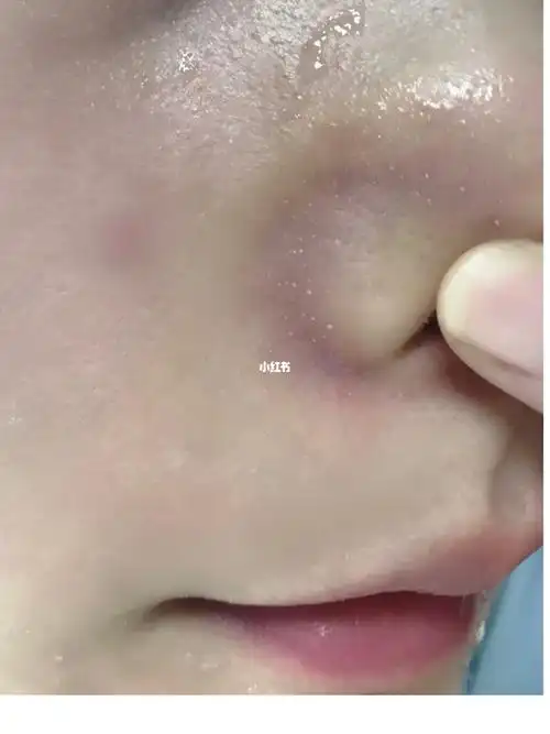 3分钟白头全部搓出来 yyds_白头_面膜_按摩_黑头粉刺_清洁面膜_茵芙莎