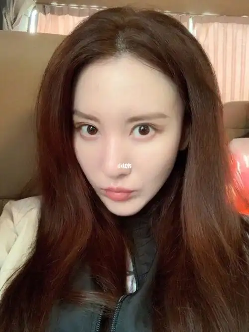 面部充气感十足张萌 如何避免面部填过度_按摩_脂肪填充_苹果肌_变美