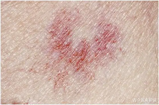 60岁夫妻查出肝癌2个月后去世医生冰箱中2种食物是罪魁祸首