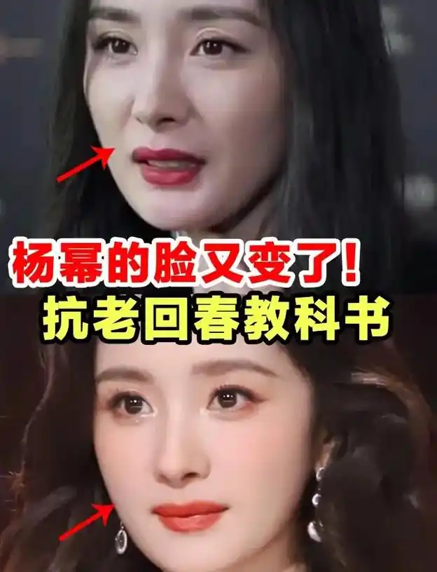 杨幂回春7515垮脸抗衰必看.