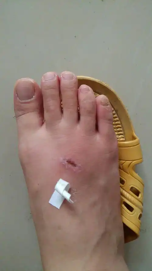 第二天,我也终于明白为啥总有小男孩从手术室里进进出出——因为那是