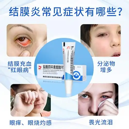 [3盒装]白敬宇盐酸四环素醋酸可的松眼膏2g结膜炎眼药膏沙眼药软膏