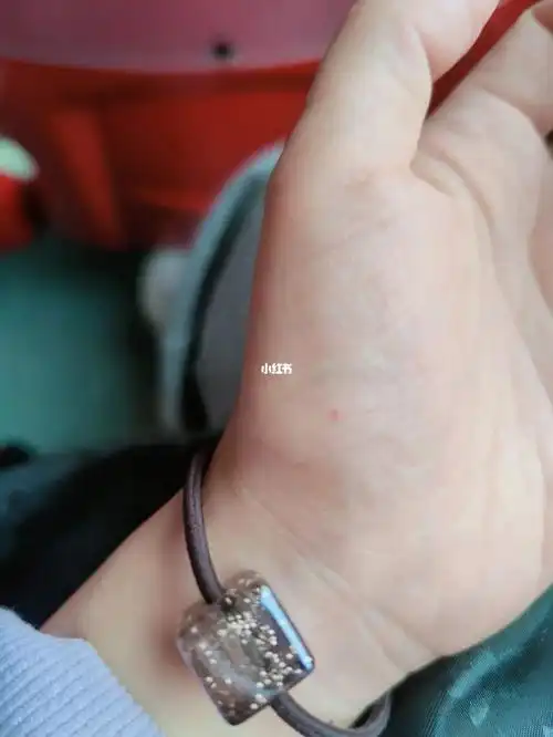 左手掌上从小就有一颗红色点点,原来是朱砂痣,以前左手小拇指上也有