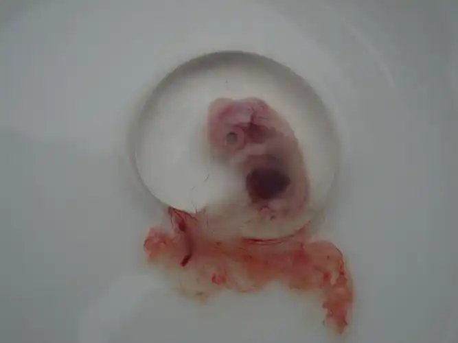 【胎儿被盗案】胎儿被盗案实为自导自演闹剧