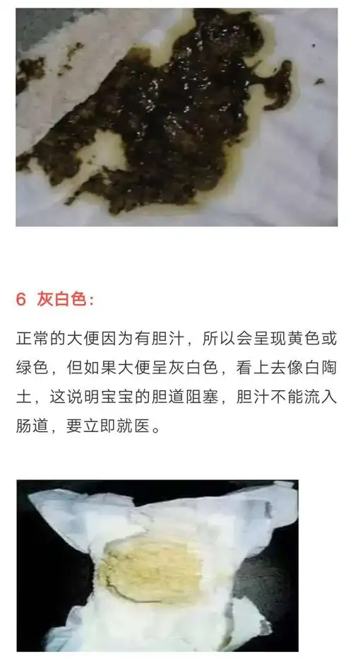 黑便,奶瓣,绿便,腹泻,便秘.宝宝的各种便便真图全解!建议收藏