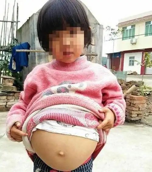 三岁女儿肚子隆起,得知医院检查结果后我再也不想见到婆婆