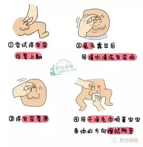 当阴茎头露出后再清洁包皮垢,然后将包皮复原,否则易造成嵌顿包茎.