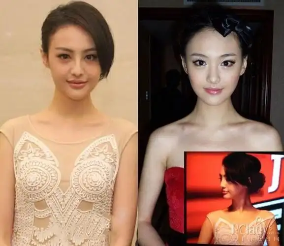 郑爽杨幂林峰 盘点乱整容毁气质的明星(图) -缪清明 -搜房博客