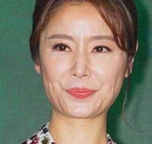 林心如这是怎么了?皮肤松弛满脸皱纹,卖萌表情更是吓坏网友