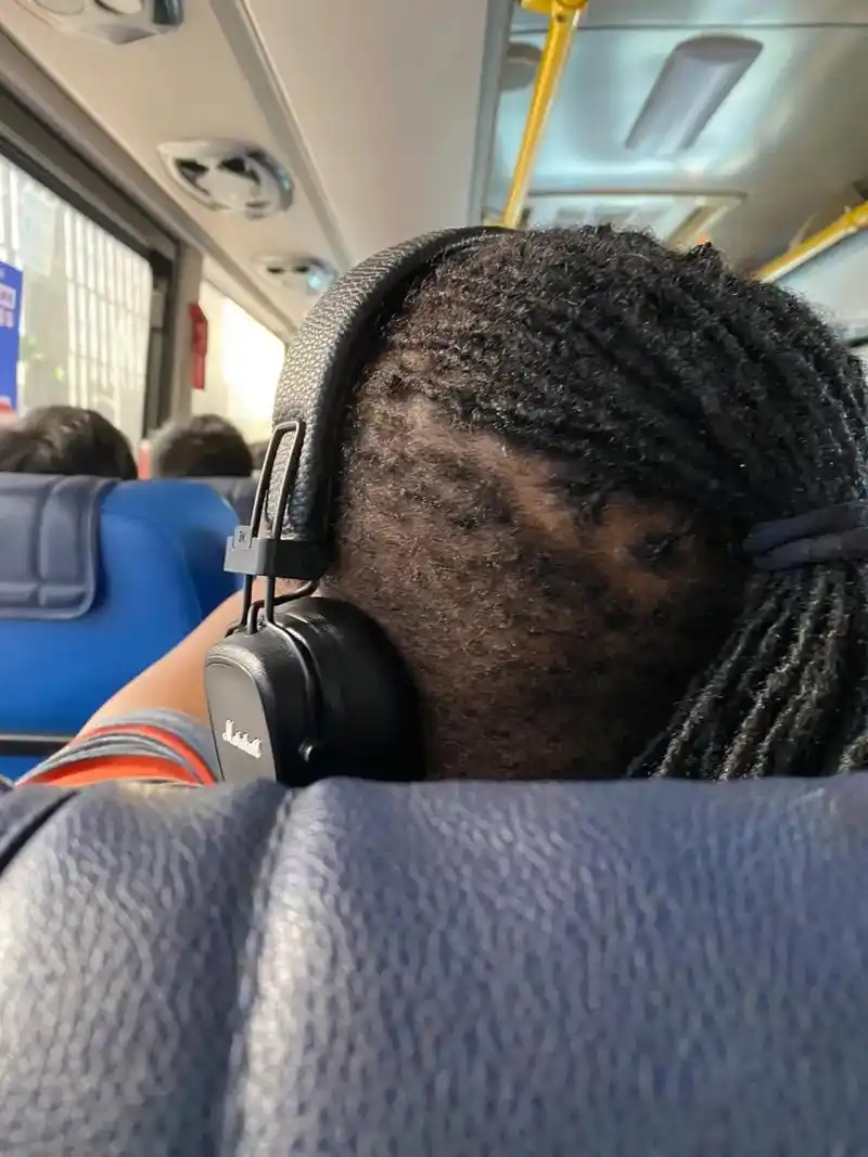 的头发 原来长出来就像绒毛一样的,但是怎么弄成一缕缕然后扎起来呢?