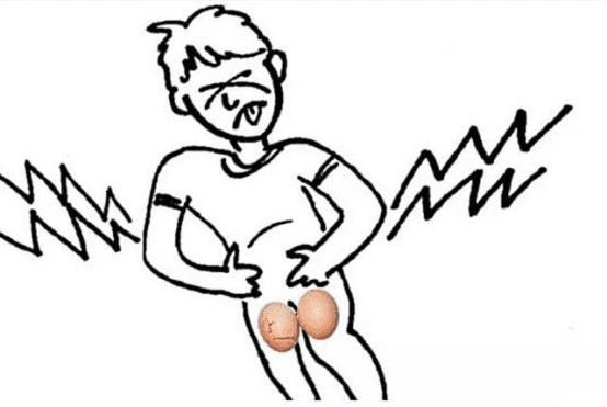 为什么会"蛋疼"?了解睾丸疼痛怎么办