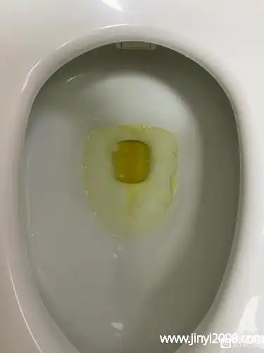 所以有些人会有吐出胆汁后还会再次呕吐的症状,若是症状很严重,还是