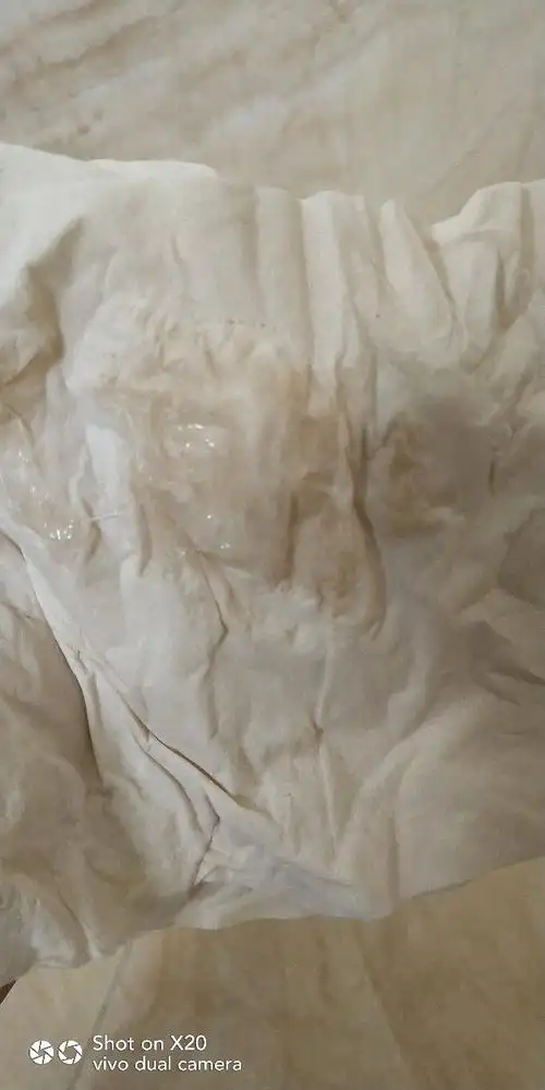 白带拉丝后多久排卵 如何判断自己是否排卵