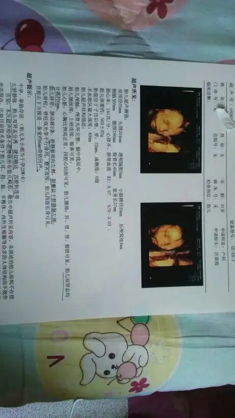 四维图出来发现宝宝好丑