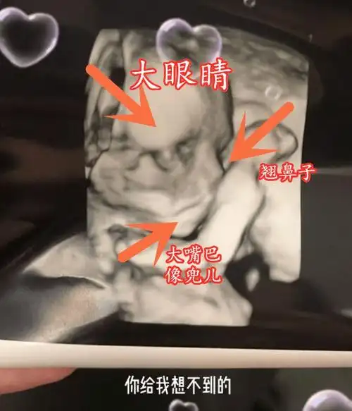 小猪先生兜儿晒孩子四维图大眼睛高鼻梁大嘴巴比小猪妹强多了