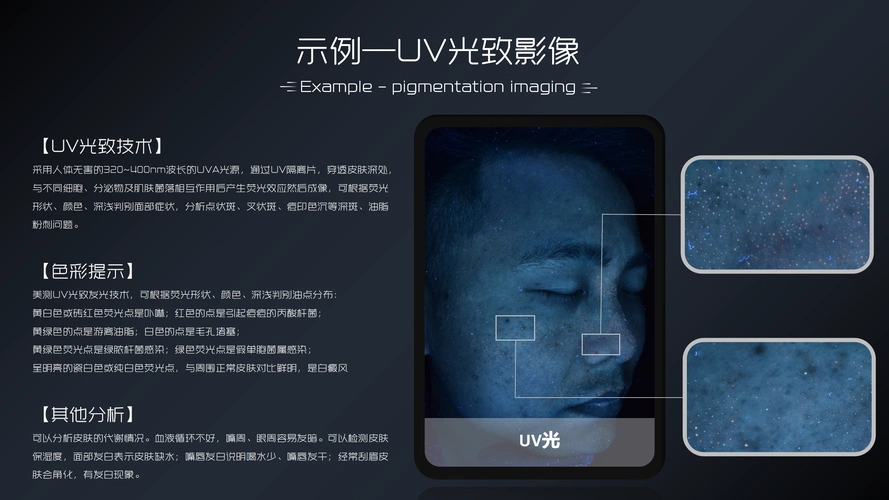 2021美博会皮肤检测仪以色美科思图影像分析仪云镜