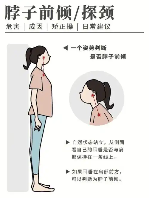 脖子前倾的危害有哪些7171