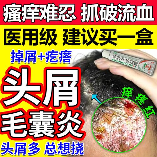 毛囊炎头部专用效药头上长疙瘩脓包 头皮屑多瘙痒头部毛囊炎抗菌药膏