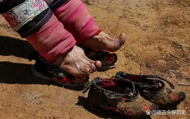 在古代,裹小脚是一个非常让女子受伤害的封建礼俗.