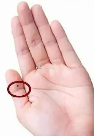 大拇指有痣父母就是他们此生的贵人.