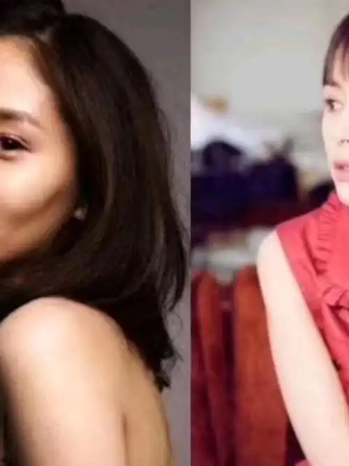 恰到好处的脂肪填充,王子文做的太绝了6015欢乐颂时期_圈子-新氧