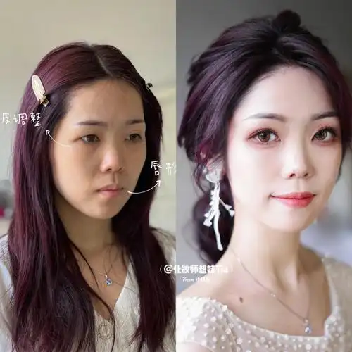 单眼皮变双眼皮之间只差一个我