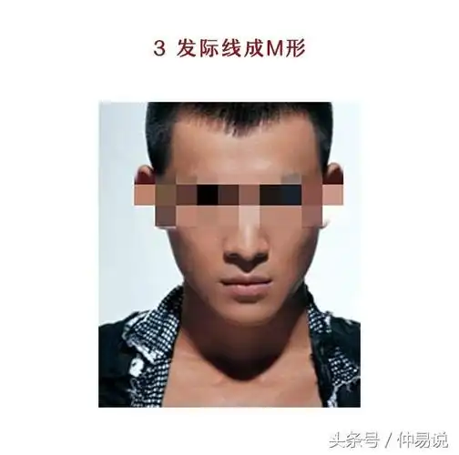 三种常见的发际线,圆形,美人尖,m形发际线的命运分析