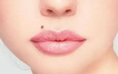 桃花痣的寓意 有桃花痣代表着什么 - 缘来呀