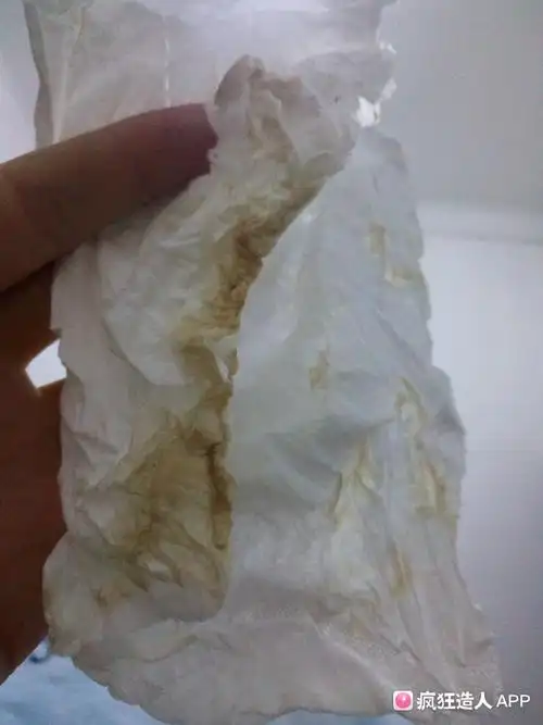 怀孕95天了,今早起来流了些褐色分泌物,没有肚疼