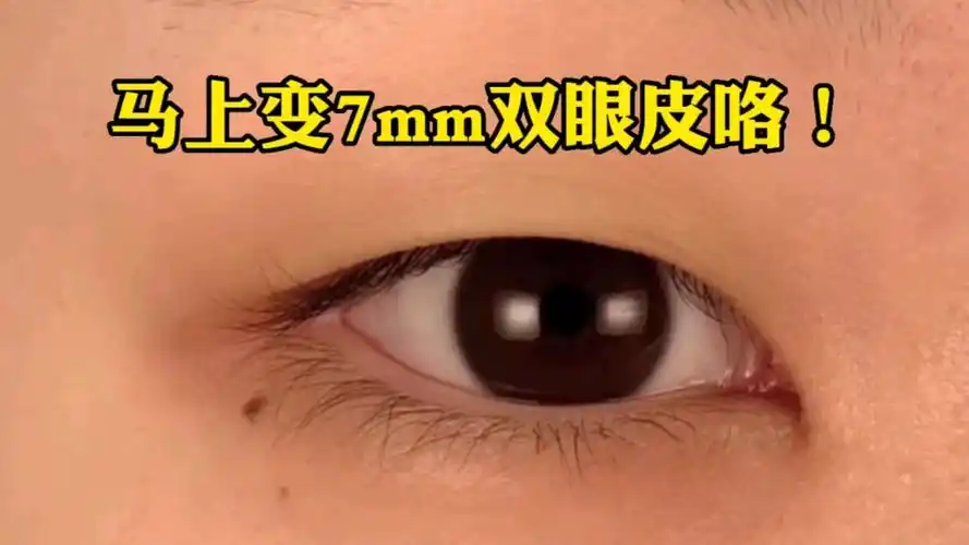马上变7毫米双眼皮啦!
