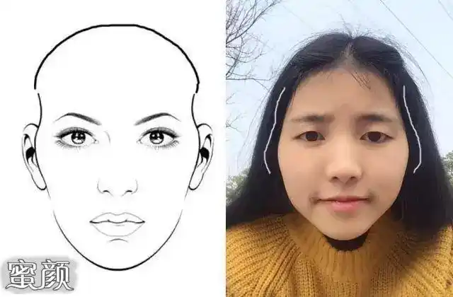 美然颧骨高的女人一克夫颧骨宽显脸大如何缩小