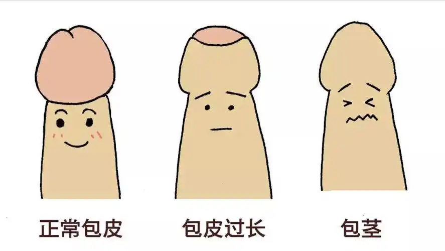 什么是包皮过长,包茎,有什么危害呢?