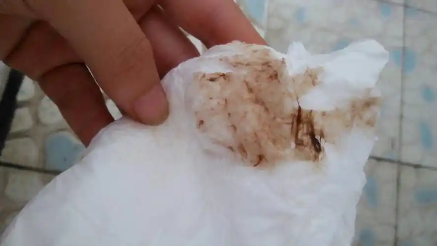 这个颜色已经持续好几天了.什么时候能好啊,急死了.