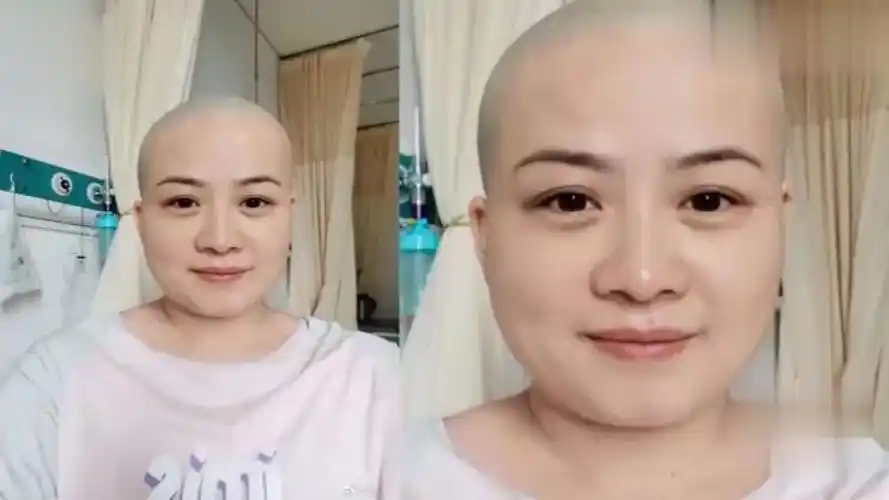 岳云鹏老婆晒剃光头照引网友担心,郑敏回应:需要做个小手术