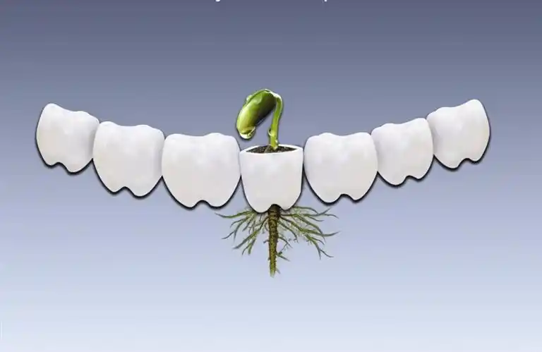 种植牙3000一颗,你干种吗?