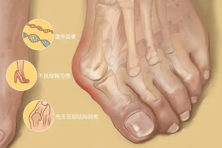 (附教学视频)_脚趾头_大拇趾_脚掌