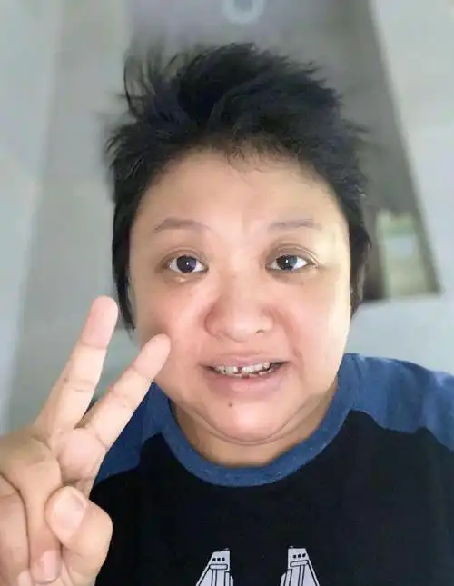 韩红怎么了?暴瘦,缺多颗牙,眼睛肿胀,戴廉价手表,让人不敢认