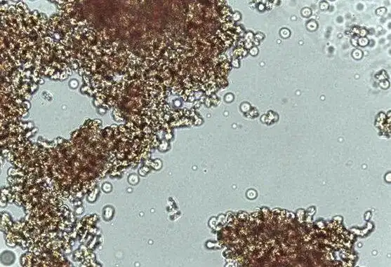 解析交叉配血中常见的凝集反应|患者|凝集反应|红细胞|抗体|交叉