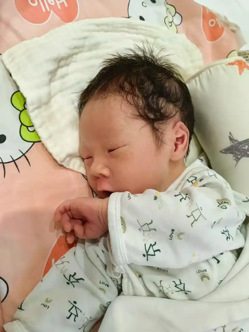 宝宝刚出生医生说宝宝耳廓粘连,要做矫正