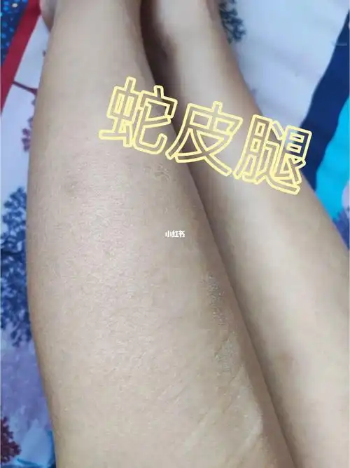 按摩,用刮痧板刮刮腿第三部,上油,精油或者按摩油