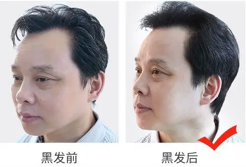 黑发神器只要洗一洗白发变黑发美美过新年