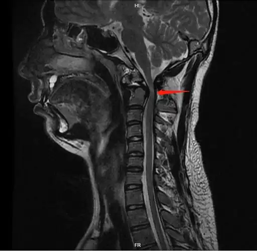 其它 重阳医院磁共振检查应用 写美篇       磁共振成像(mri)检查由于