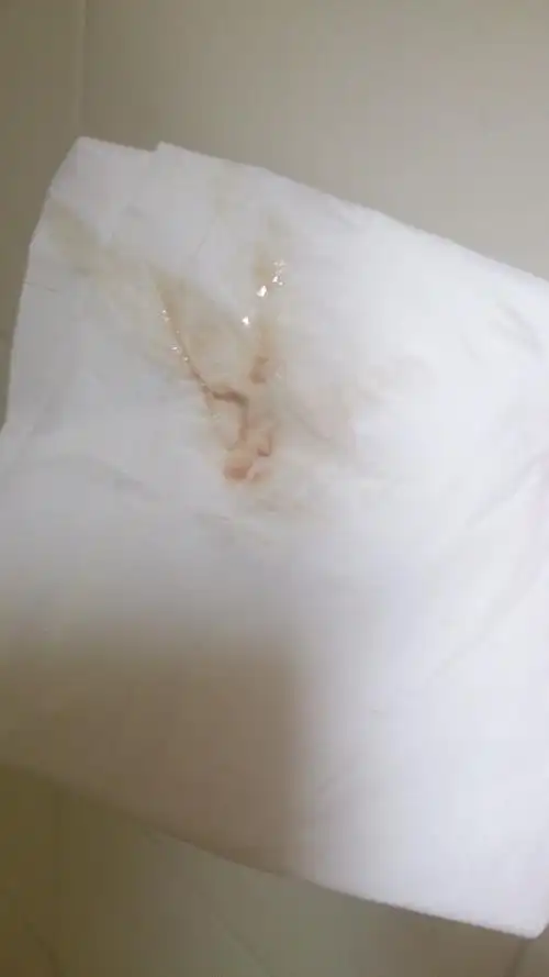 量少,持续2至3天,伴有轻微腹痛或腰酸,这种情况属于排卵期出血,为正常