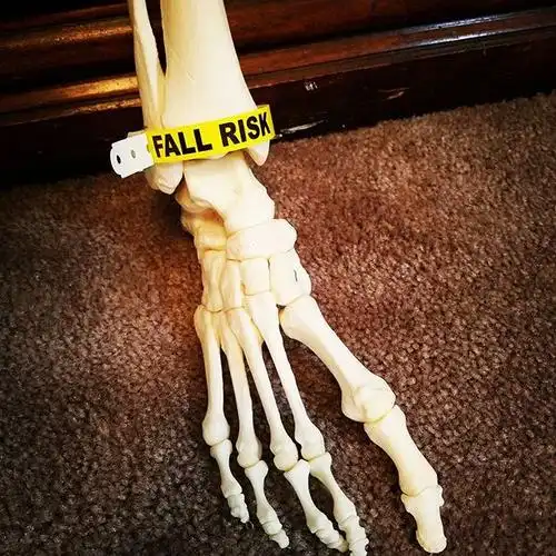 因癌症被截肢后 她和截掉的断脚成了自拍小伙伴